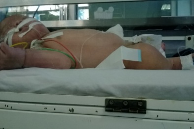 Bé trai 1 tháng tuổi nguy kịch sau khi tiêm thuốc phòng lao